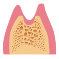 学園都市(神戸市西区)の歯医者、幸田歯科医院のむし歯治療