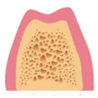 学園都市(神戸市西区)の歯医者、幸田歯科医院のむし歯治療