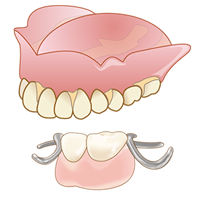 学園都市(神戸市西区)の歯医者、幸田歯科医院のむし歯治療